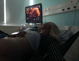 20-week ultrasound scan and gender reveal