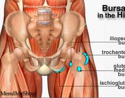 Running Injuries: Hip and thigh pain