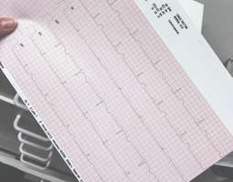 EKG ja muuta pelottavaa