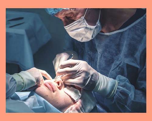 Kauneuskirurgia ja moraali