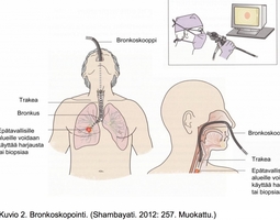 Bronkoskopia, eli keuhkoputken tähystys